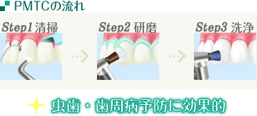 PMTC「Professional Mechanical Tooth Cleaning（プロフェッショナルメカニカルトュースコントロール）」